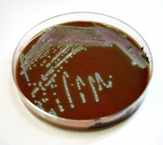 Take the Yeast-Fungus-Candida Quiz and See How You Measure Up